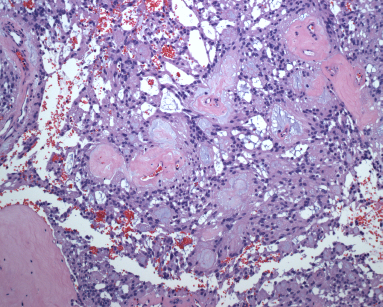 Pathology Image